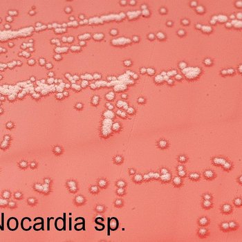 Nocardia